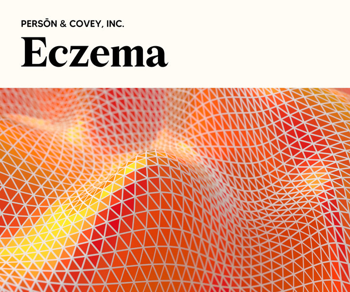 What Is Eczema?